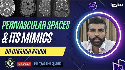 Perivascular Spaces & Its Mimics | Dr Utkarsh Kabra | DNET