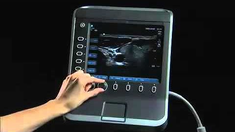 SonoSite S Series Product Training Part 1  System Overview   YouTube
