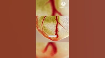 Discover of human heart in motion:A stunning unity 3D animation#humanheart #3d #heartanatomy #shorts