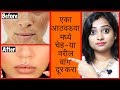        home remedies for pigmentation