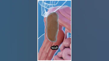 ما هو انحشار البراز في القولون 