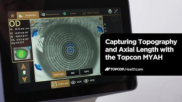 Capturing Topography and Axial Length Measurements with the Topcon MYAH