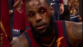 LeBron gets hit in the face and bleeds!