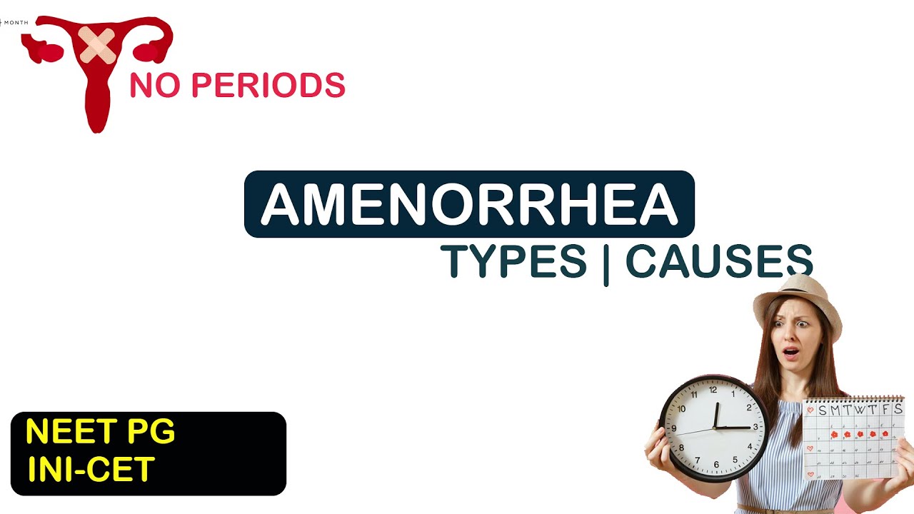 Absence of menstruation (amenorrhea): 13 causes