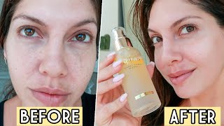 6 MILLION SOLD! I TESTED THIS POPULAR K-BEAUTY BRAND | d’Alba White Truffle Spray Serum #GlowingSkin by Stefania Briella 14,899 views 3 years ago 13 minutes, 14 seconds