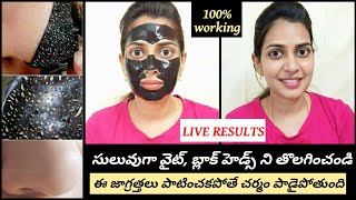 How to use charcoal peel off mask in telugu | Easy DIY Blackheads & whiteheads removal peel off mask