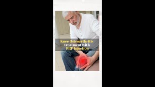 Knee #osteoarthritis treatment with #PRP Injection #recovery #askdrmanu screenshot 1
