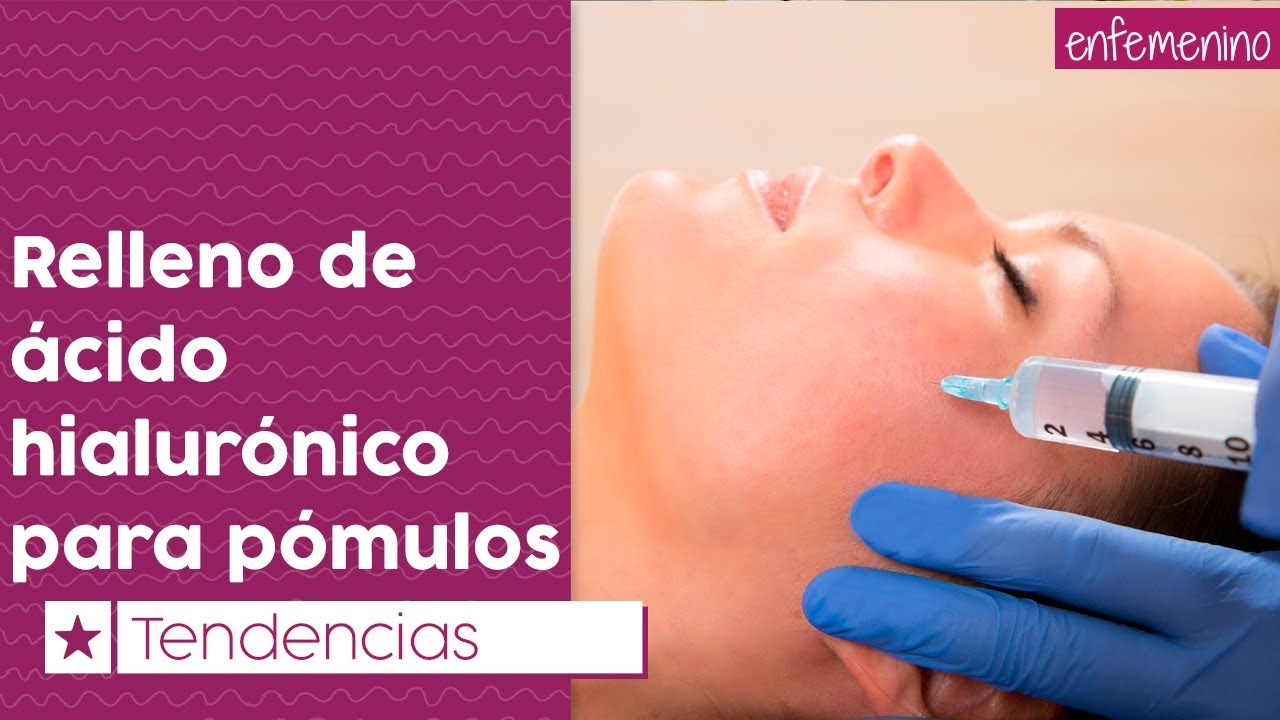 Relleno de ácido hialurónico para los pómulos, ¿cómo funciona? YouTube