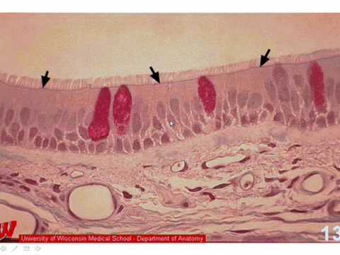 Respiratory system histology - YouTube