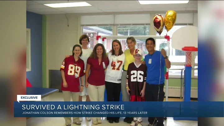 This man survived a lightning strike