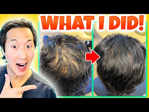 How I Treated My Thinning Hair the Holistic Way!