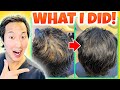 How i treated my thinning hair the holistic way