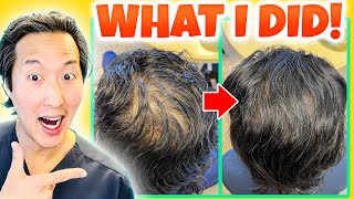 A Holistic Doctor's Plan to Grow My Hair Back - Dr. Anthony Youn