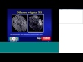 Neuro Imaging of Encephalitis by Dr Suresh K