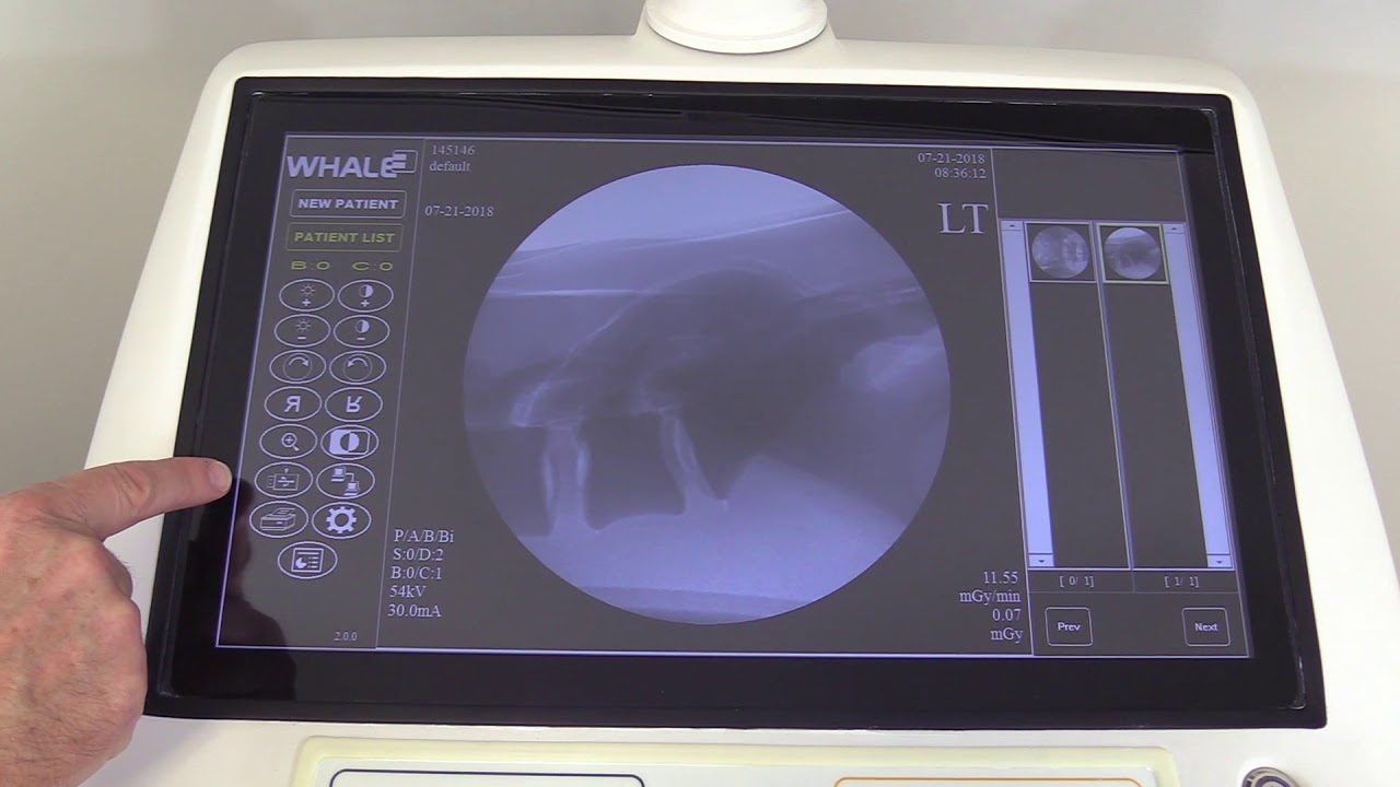 G-Arm B6 Duo Training Pt2 Console Operation