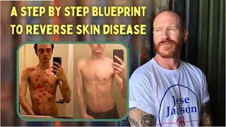 Revealing the complete step by step BLUEPRINT for permanent eczema, psoriasis, dermatitis reversal screenshot 1