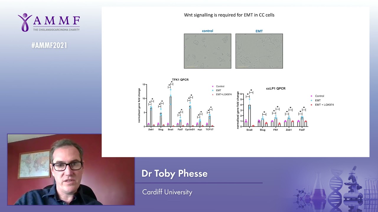 The therapeutic benefit  of targeting Wnt receptors in metastatic CCA