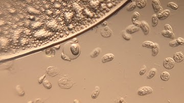 Ciliate surfing on a mystery sphere - Foldscope Gallery