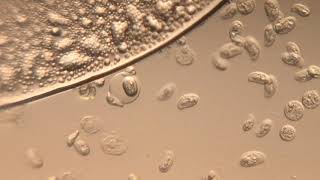 Ciliate surfing on a mystery sphere - Foldscope Gallery