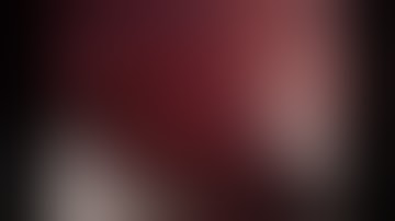 Asvide: Uniportal video-assisted thoracic surgery right upper lobectomy with systemic...