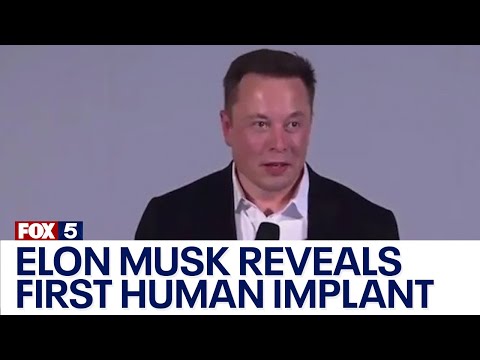 Elon Musk says the first human has received an implant from Neuralink, but other details are scant
