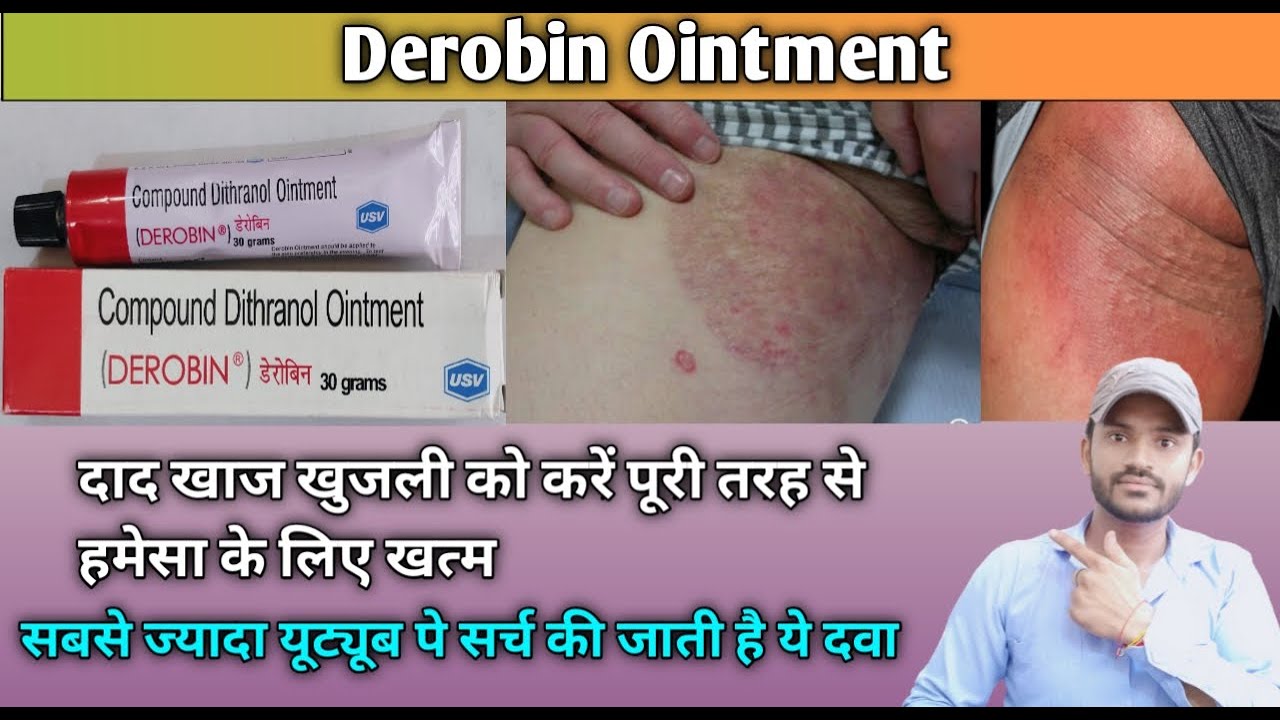 Derobin oimtment use dose benefits and Side effects full review in hindi