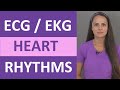 EKG Rhythms ECG Heart Rhythms Explained Comprehensive NCLEX Review 