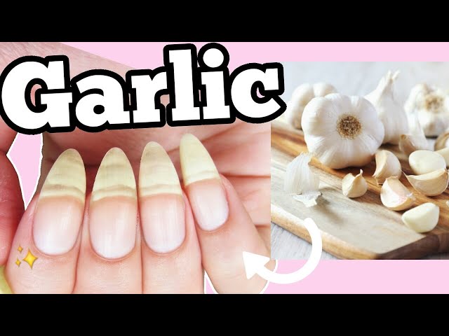 Growth with Garlic Nail Treatment // Nail Repair // Côte – côte