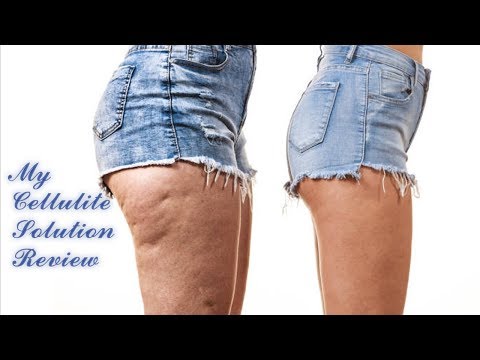 my-cellulite-solution-review-important-notice-about-my-cellulite-solution