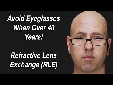 Vídeo: Na troca de lentes refrativas?