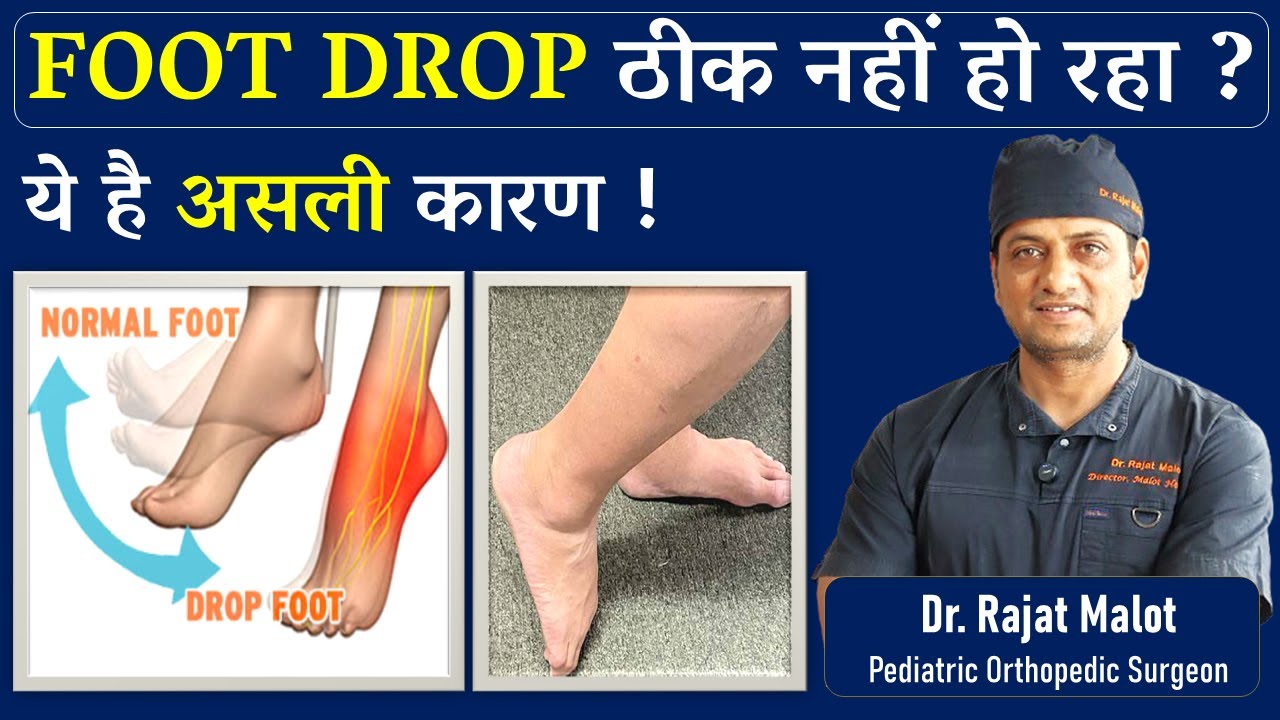 FOOT DROP ठीक नहीं हो रहा ? | Foot drop Causes, symptoms, and treatment | Dr Rajat Malot