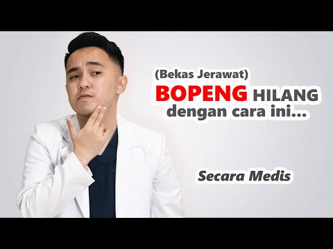 Yoo guys welcome back setiap seminggu sekali atau kemungkinan gw bakal lebih rajin upload lagi untuk. 