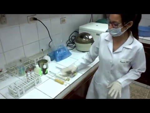 Vídeo: Examen De Sangre De Amilasa: Propósito, Procedimiento Y Resultados