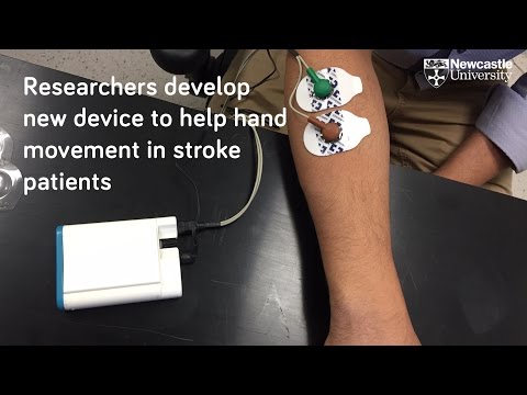 Device to help stroke patients recover hand movement