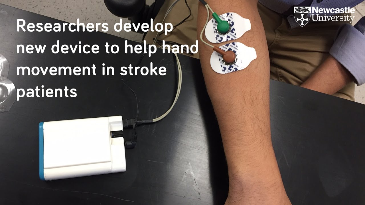 Will Electrical Stimulation Help Me Recover From Stroke?