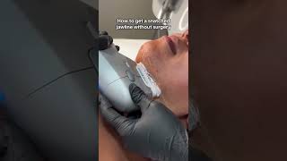 Ultraformer 3 - Hifu Tightens Skin And Melts Stubborn Fat Pockets