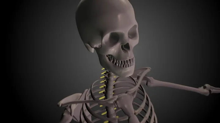 Cerebral Spinal Fluid Leak (CFS)