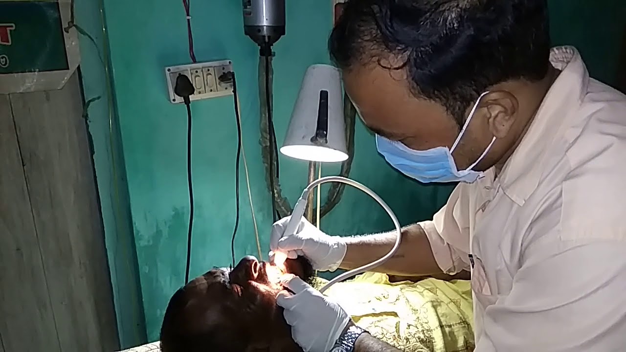 Dental scaling YouTube