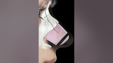 Rhinoplasty (Nose Job) Video Animation by KAMINSKYI