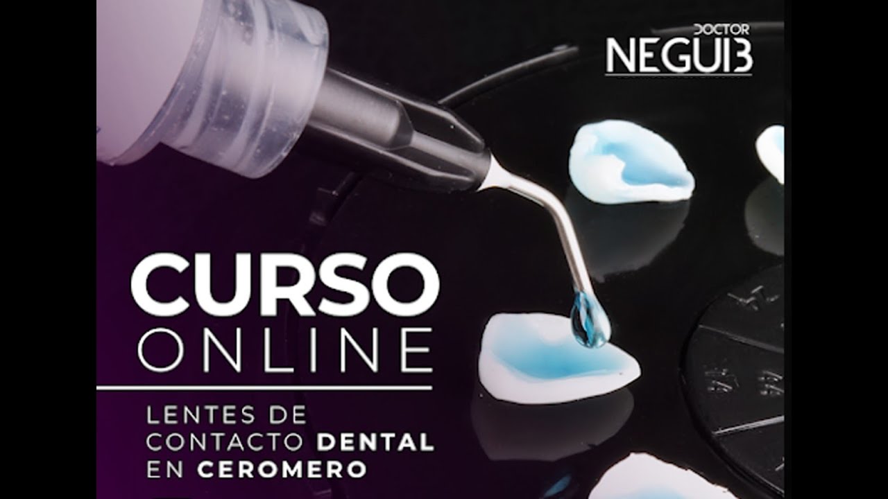 Carillas de Cerómero Monolítico: Módulo 1