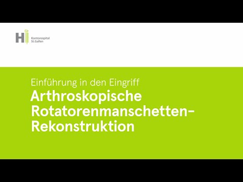 Arthroskopische Rotatorenmanschetten-Rekonstruktion - Wie funktioniert das?