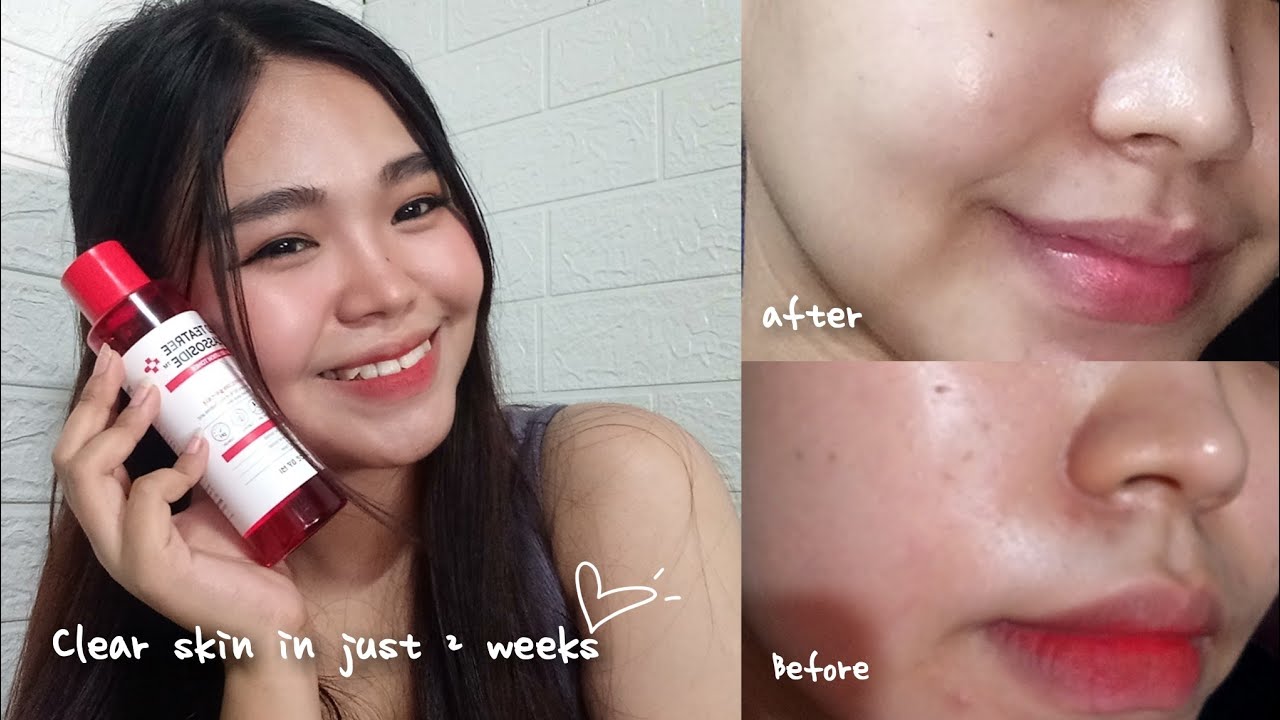 Korean Skin Care Review (yesstyle)  | gloancleare