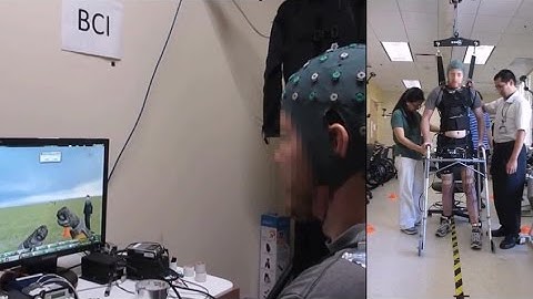 Brain-computer interface restores walking after paraplegia