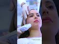 HIFU Treatment at 38,499