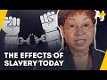 Post Traumatic Slave Syndrome. How Is It Different From PTSD?  | AJ+ Opinion