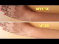 How To Remove Sun Tan From Your Body Instantly | Home remedy