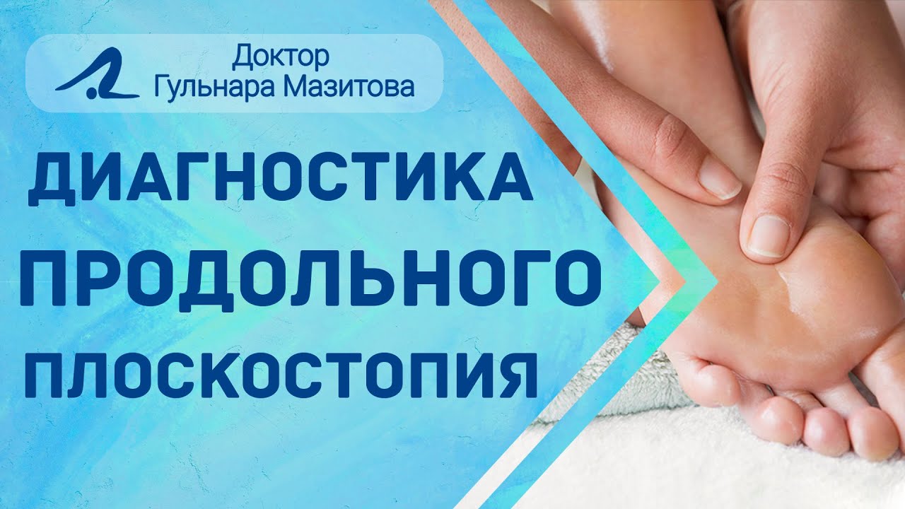 Продольное плоскостопие. Как определить?