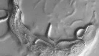 High Speed Camera Acquisition C. elegans reproducing