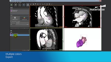 How to Prepare & Export Monochrome or Multi-color 3D-printed Models | Mimics inPrint Tutorial