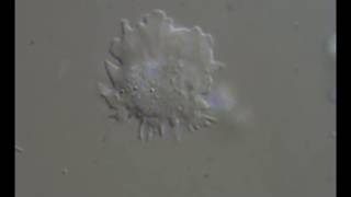 Vexillifera Abyssalis Kudryavtsev, Pawlowski Et Smirnov, 2018 Ccma0006 Accelerated 2X